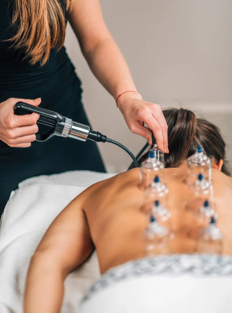 cupping door Vitalité
